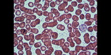 Células sanguíneas 3