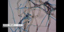 Práctica: Observación de micelios de mohos teñidos con lactofenol