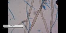 Práctica: Observación de micelios de mohos teñidos con lactofenol