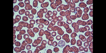 Células sanguíneas 4