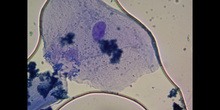 Células de la mucosa bucal 2