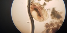 Imágenes de pulga de agua (Daphnia pulex) 4